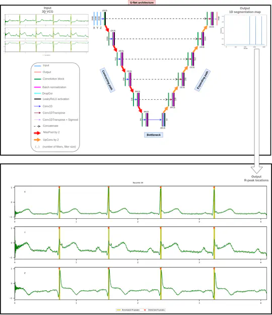 Real‑time ECG Signal detection using DL on edge devices (with Epsidy)